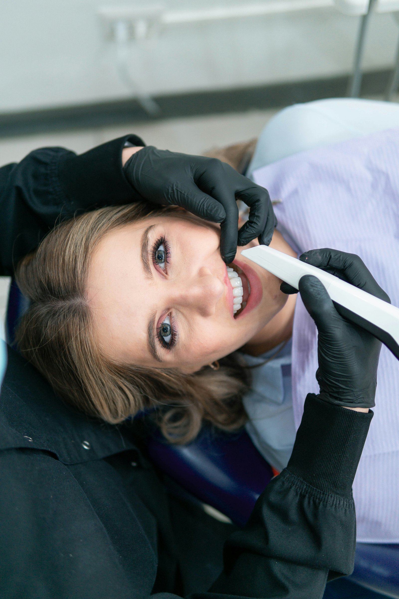 Intra Oral Scanning