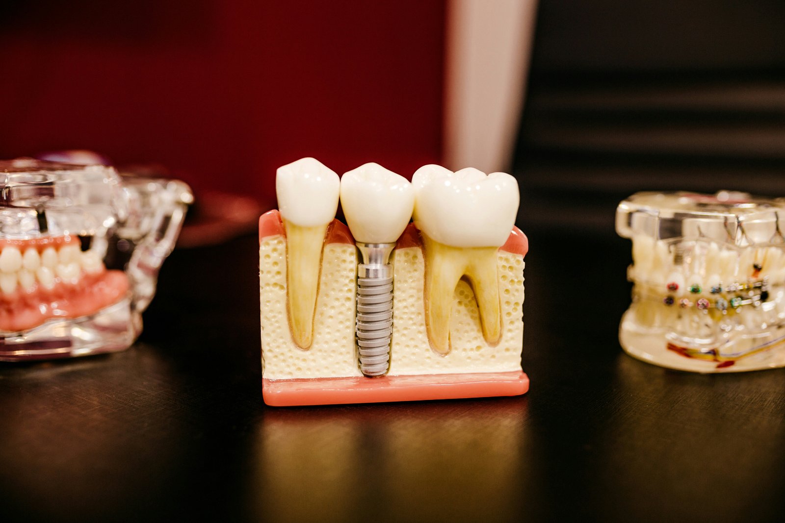 Root Canal Treatment