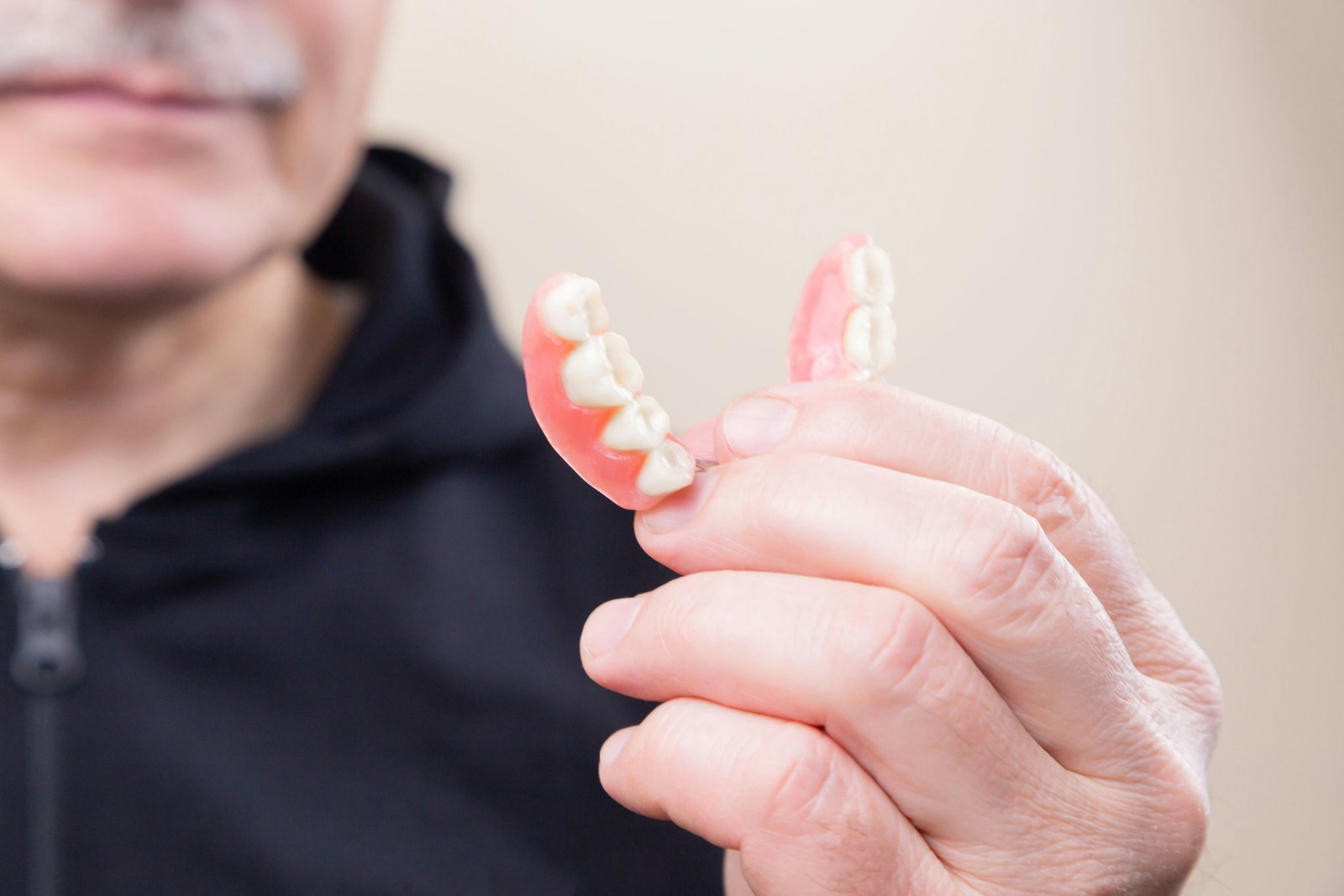 RPD (Removable Partial Denture)